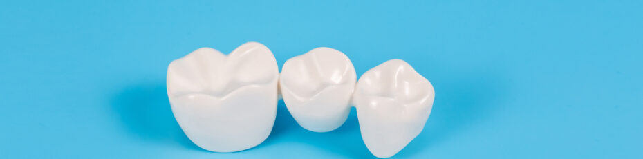 dental crown lifespan factors and maintenance tips