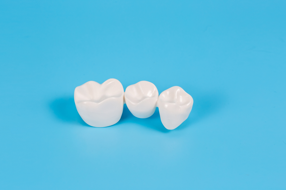 dental crown lifespan factors and maintenance tips