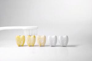 the real reasons your teeth are turning yellow