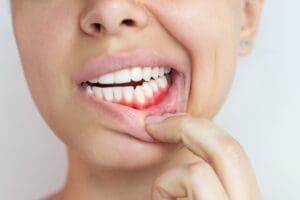 why are my gums dark? common causes explained