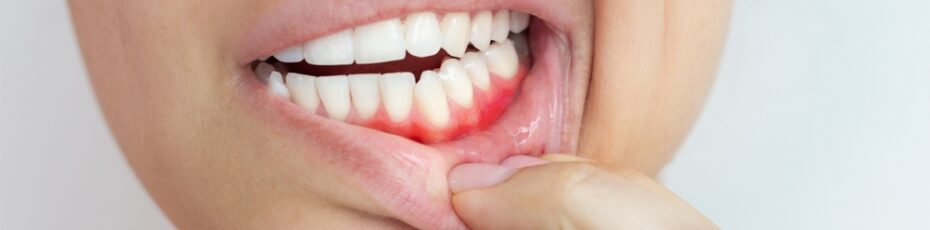 why are my gums dark? common causes explained