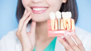 Dental Implants Near Me