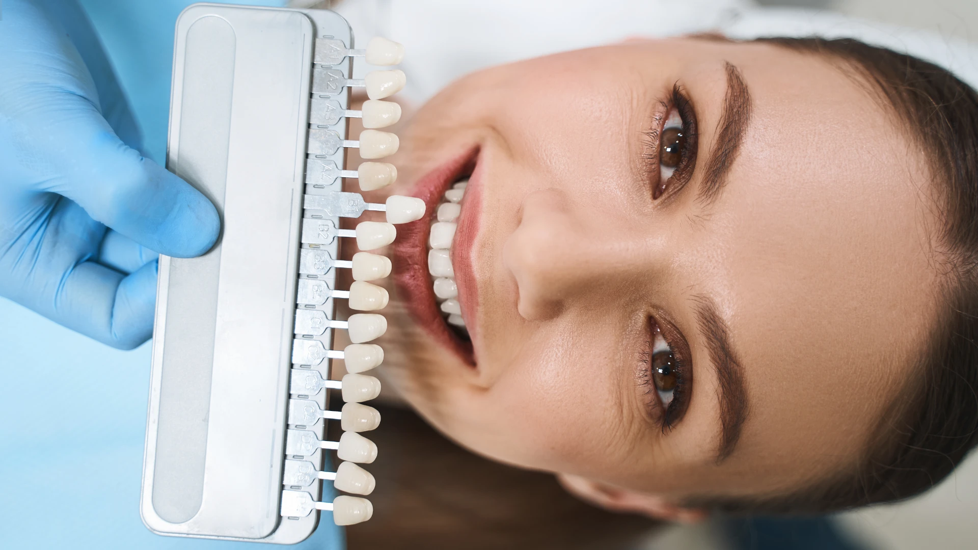 Veneers Calgary