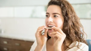 Invisalign Calgary