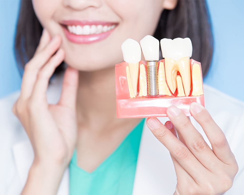 dental-implants-nw-calgary