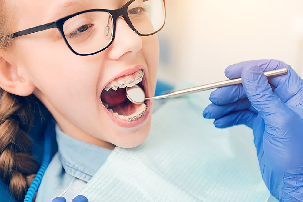 orthodontics-nw-calgary