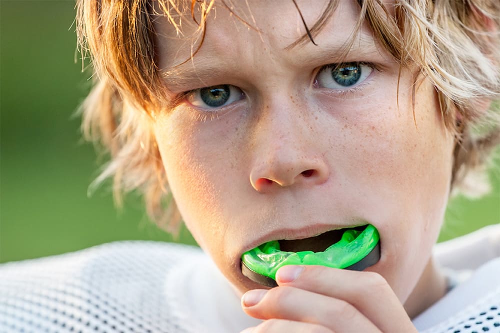 sports-guards-nw-calgary