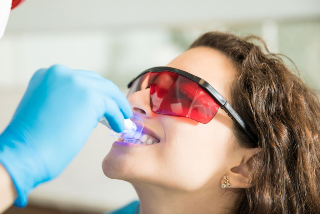 How Long Does Teeth Whitening Last?